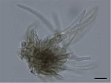 Conidiophore of Pseudocercospora jatrophae. Scale bar = 10 µm.