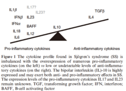 Cytokine profile in Sjogren’s syndrome (SS).png