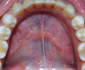 Vorschaubild für Mundboden