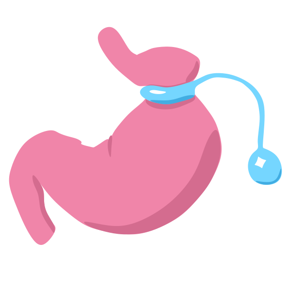 File:Gastric banding Icon.svg