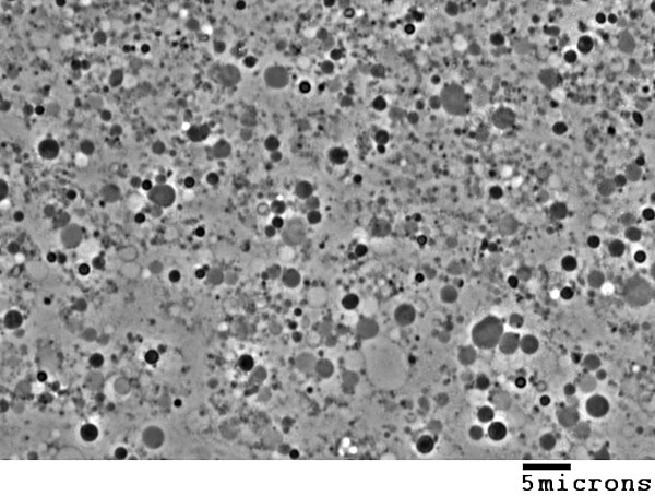 Phase contrast image of L-form cells from Bacillus subtilis showing a range of sizes. Scale bar is 5 micrometers.