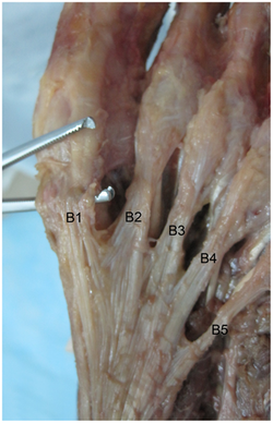 Five central part plantar aponeurosis bundles. Plantar aponeurosis - central.png