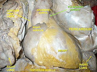 Die Arteria pulmonalis ist ein