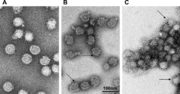 Thumbnail for Tick-borne encephalitis virus