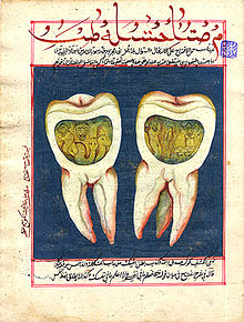 18th century hand-illustrated page from an Ottoman Turk dental book Tooth worm.jpg