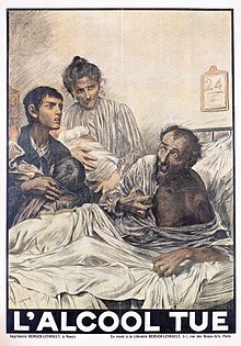 Transient global amnesia - Wikipedia