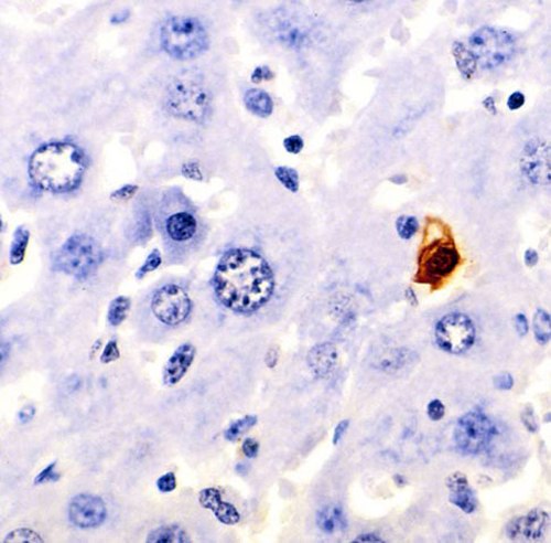 A section of mouse liver stained to show cells undergoing apoptosis (orange)