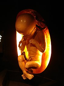 Feticidio: Concepto, Historia, En el aborto legal