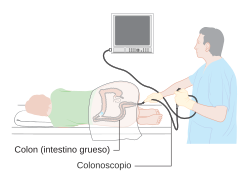 Diagrama mostrando una colonoscopia.svg