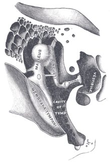 Otosclerosis Condition characterized by an abnormal bone growth in the middle ear