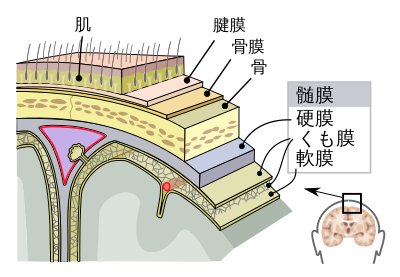 髄膜炎