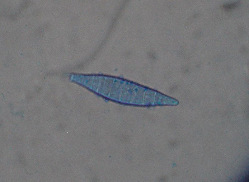 File:Microsporum canis 1.JPG