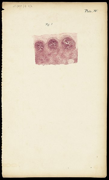 File:Watercolours of micrococcus, by Lady Mary Bruce OBE Wellcome L0064616.jpg