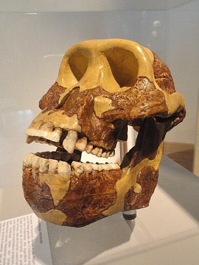 Dit model toont de diastemen en de verticaal verder uitstekende voorste tanden
