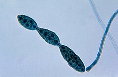 Bir Alternaria sp.'nin conidia zinciri.  mantar PHIL 3963 lords.jpg