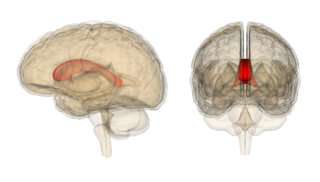 Marchiafava–Bignami disease Medical condition