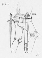 Перенесення знімного коловорота на поясі. Малюнок 1874 р.