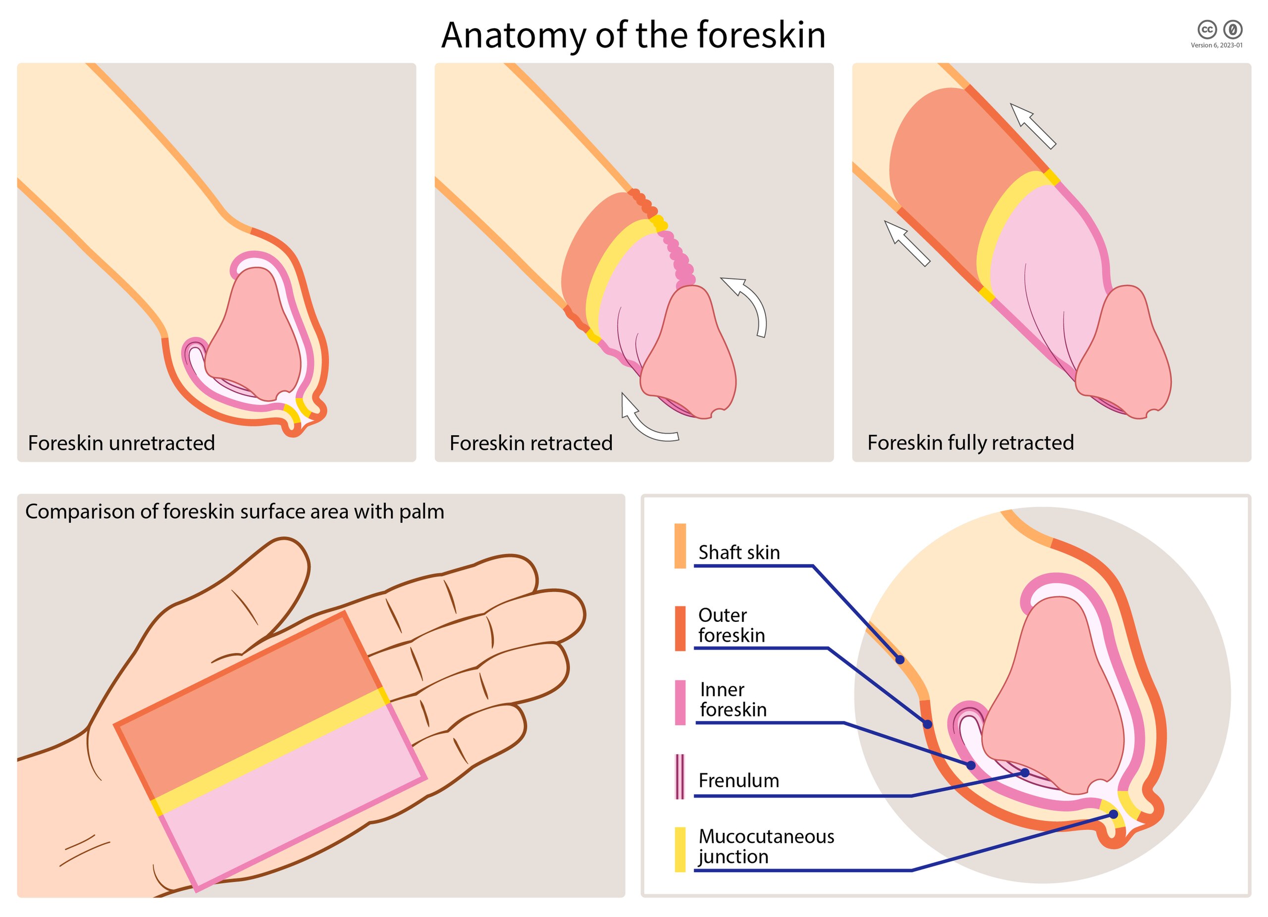 File:Foreskin Anatomy WIKI-EN.jpg - Wikimedia Commons