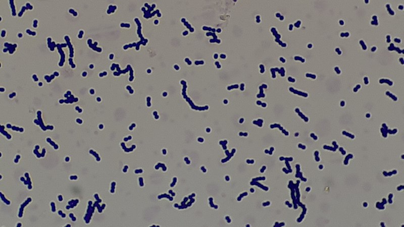 File:Gram Positive Cocci.jpg