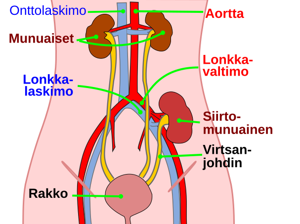 File:Kidtransplant-fi.svg