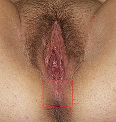 Pics Of Womens Anus