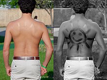 Human skin with a sunscreen drawing: in light and ultraviolet radiation. Sunscreen on back under normal and UV light.jpg