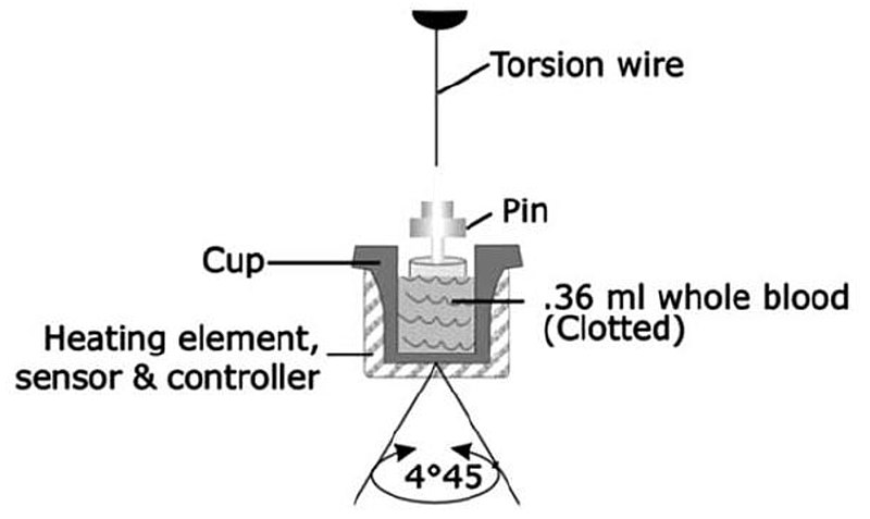 File:Thromboelastography mechanics.jpg