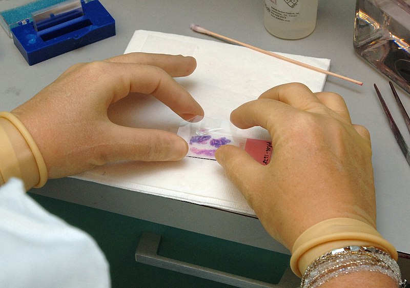 File:Tissue processing - Stained section on the slide is mounted under a thin glass coverslip.jpg