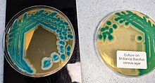 Bacillus cereus colonies on the indicator media Brilliance Bacillus cereus agar Bacillus cereus colonies on the indicator media.jpg