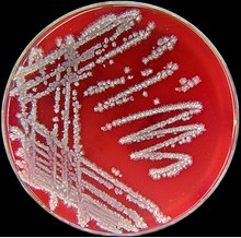 Bacillus licheniformis.jpg