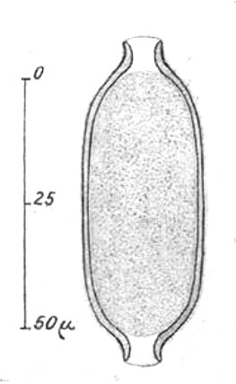 File:Capillaria polonica egg.tif