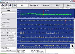 Screenshot of Holter ECG software Cubeholter.jpg