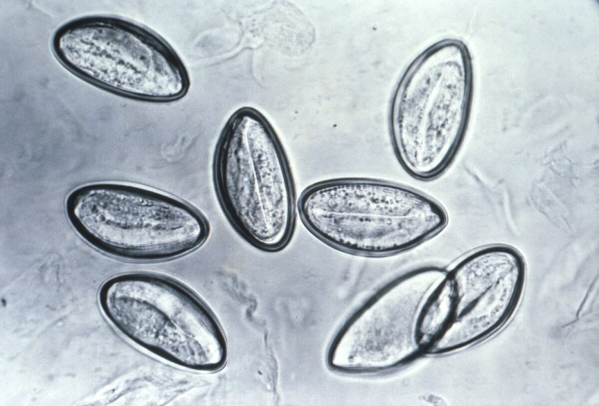 enterobius vermicularis hembra