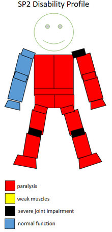 Functional profile of a wheelchair sportsperson in the F2 class. F2 SP2 disability sports profile.png