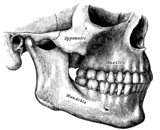 Orthognathic surgery