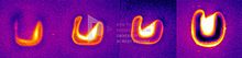 IRNDT evaluation with an indication of weld imperfections and a correct weld of lap joint. IRNDT fig 05 en.jpg