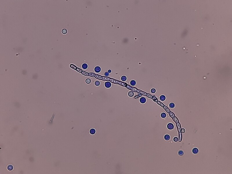 File:LPCB Mount of Cryptococcus growth on SDA microscopic footage.jpg