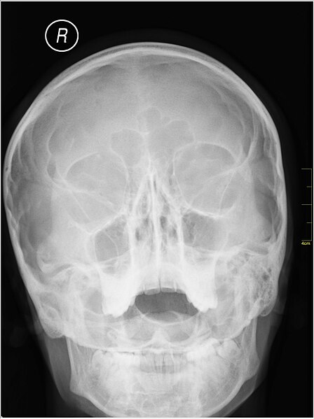 File:Medical X-Ray imaging EOL04 nevit.jpg
