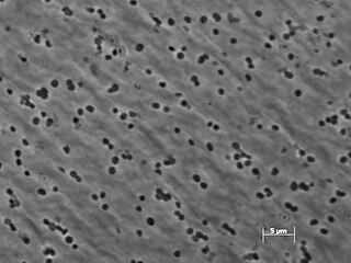 <i>Methanimicrococcus</i> Genus of archaea