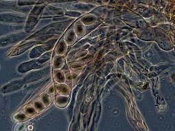 Asci of Morchella elata, containing ascospores Morelasci.jpg