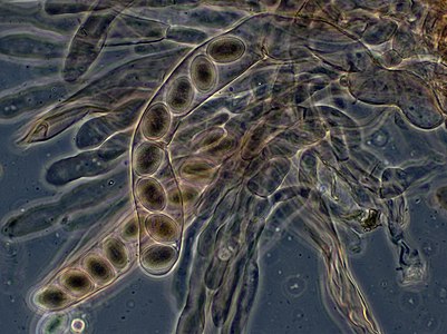 Morchella elata (Black Morel) asci and ascospores