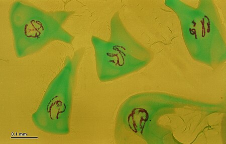 Fail:Polytene chromosomes (263 12) Salivary glands of nonbiting midges larvae (Chironomidae).jpg