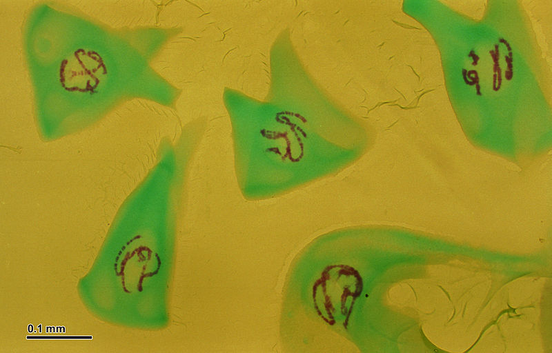 File:Polytene chromosomes (263 12) Salivary glands of nonbiting midges larvae (Chironomidae).jpg