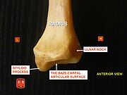 橈骨的骨莖突 - 前視圖