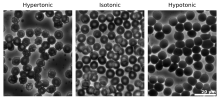 Micrographs of osmotic pressure on red blood cells Human Erythrocytes OsmoticPressure PhaseContrast Plain.svg