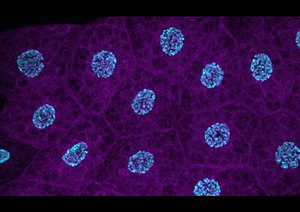 Stained cells of an insect fat body Insect fat body (14523466058).jpg