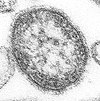 麻疹ウィルス（資料/GFDL）