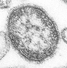 "Measles morbillivirus" electron micrograph