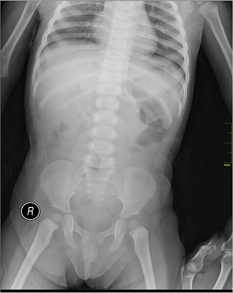 File:Medical X-Ray imaging SUE07 nevit.jpg