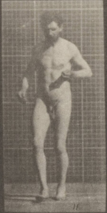 Fail:Nude man with lateral sclerosis walking (rbm-QP301M8-1887-548d~11).jpg